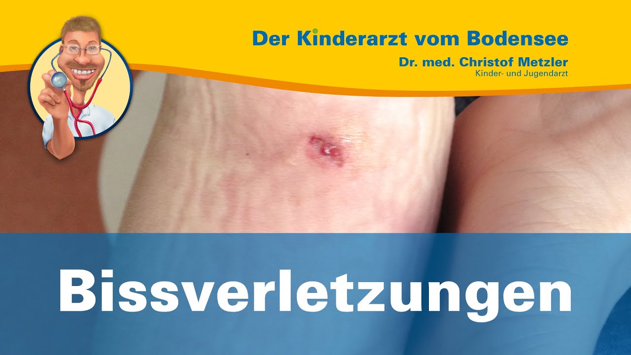 Video-Thumbnail